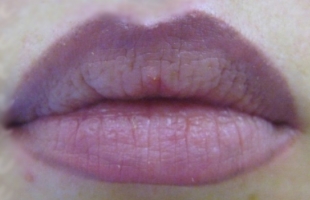 Синие губы — признак какой болезни?